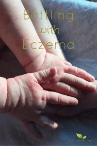 Battling with Eczema